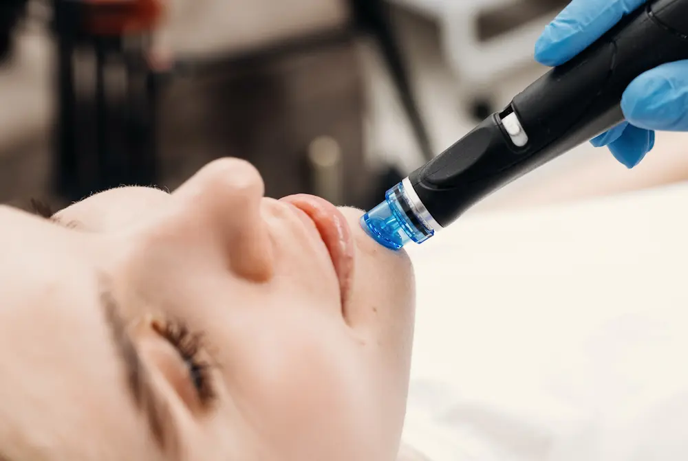 Hydrafacial Procedure