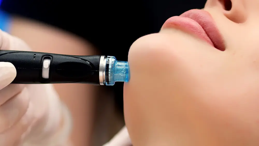 Hydrafacial Procedure