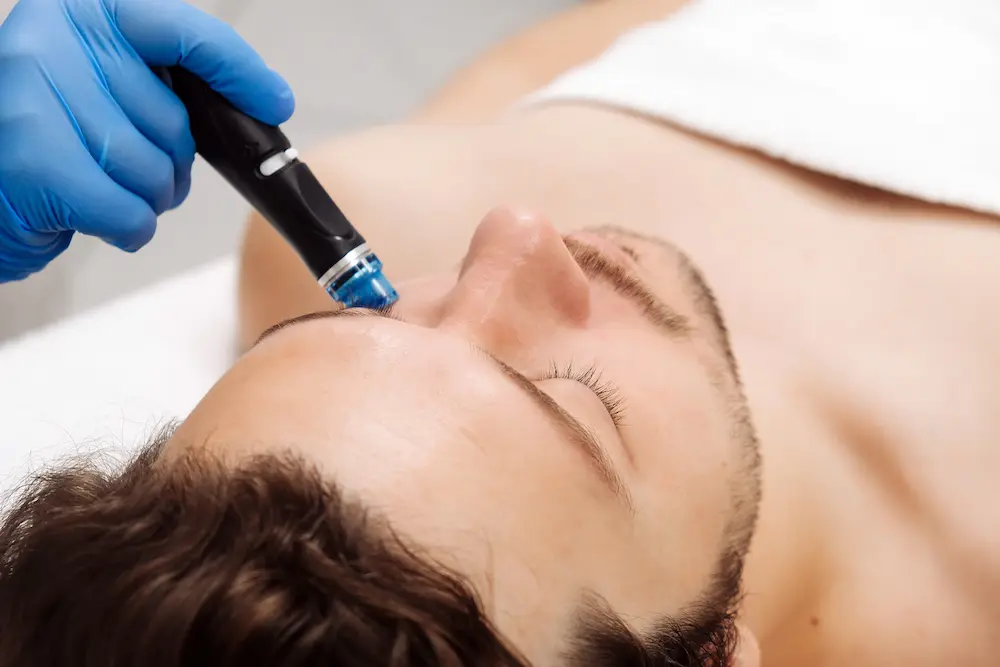 Hydrafacial Procedure